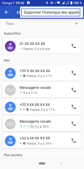 Étape 5 :